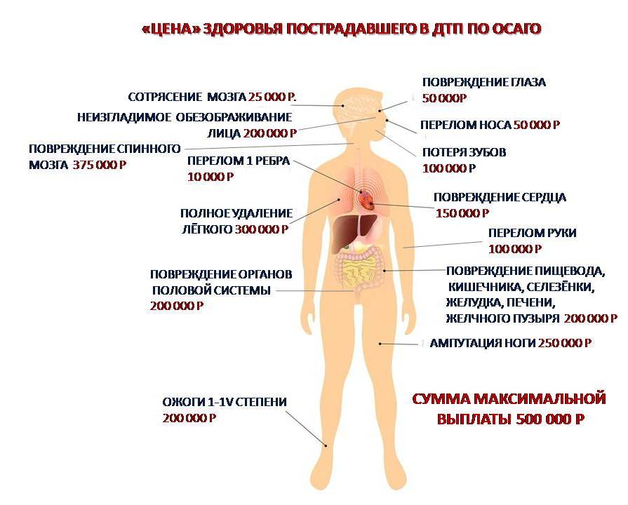 Причинение тяжкого вреда здоровью при ДТП